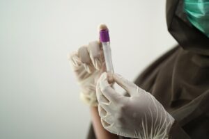 医療脱毛がホルモンバランスに与える育毛への影響とは？