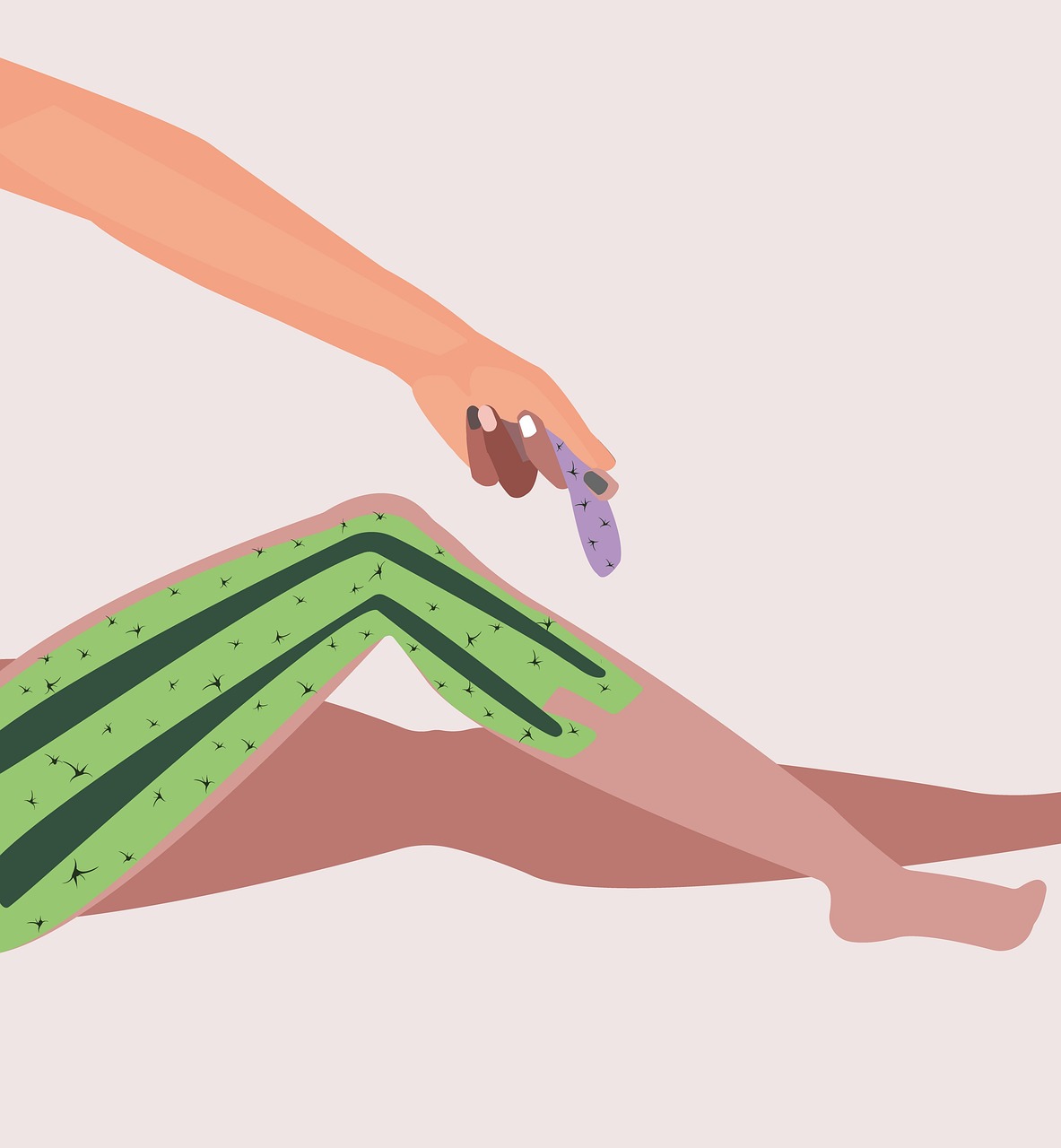 医療脱毛における脱毛機のタイプの違いは何ですか？