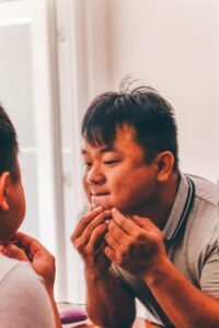 医療脱毛はニキビ肌でも施術が可能なのか？